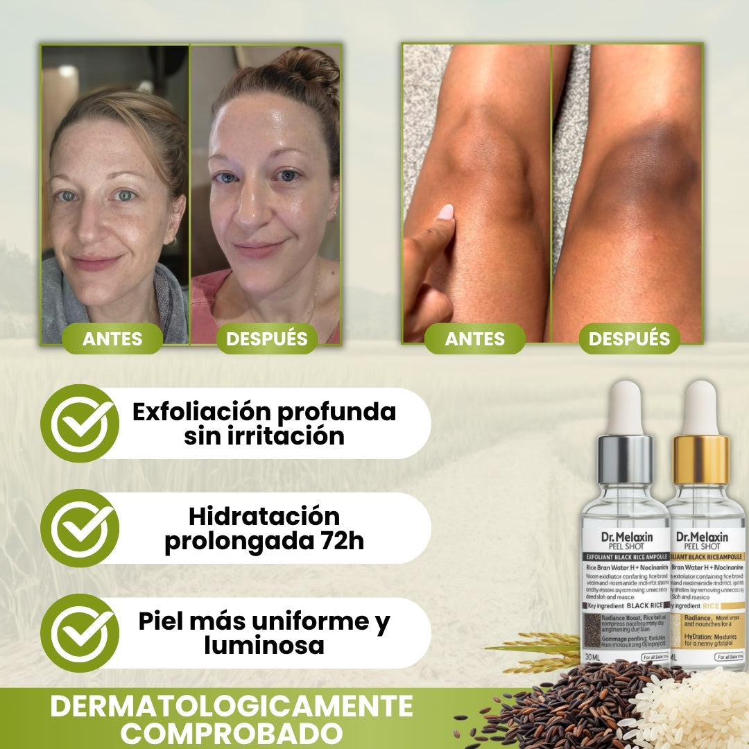 DrMelaxin™ | Kit de Ampollas exfoliantes de Arroz Blanco & Arroz Negro 30ml