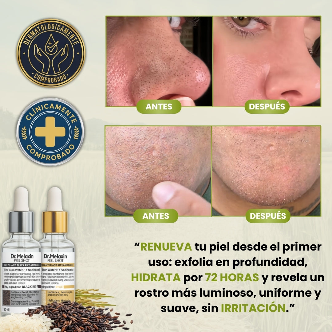 DrMelaxin™ | Kit de Ampollas exfoliantes de Arroz Blanco & Arroz Negro 30ml