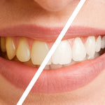 😁 AQUADENT - Irrigador Dental: Dientes limpios, saludables y blancos